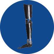FullStride Case Study I - Extending the Performance of a Stance Control Orthosis (SCO)